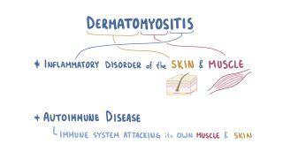 Dermatomyositis