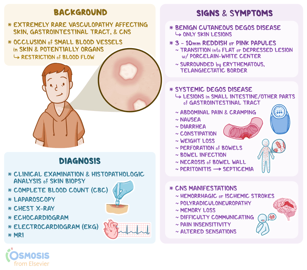 An infographic detailing Degos disease