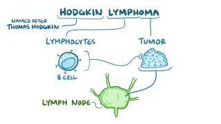 Hodgkin lymphoma