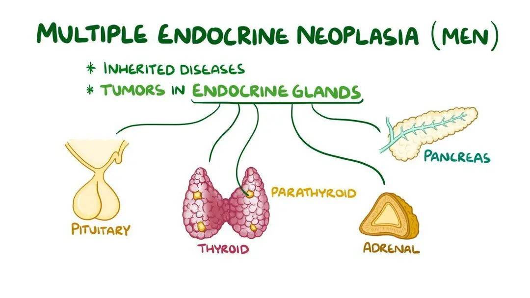 View of Video: Multiple endocrine neoplasia