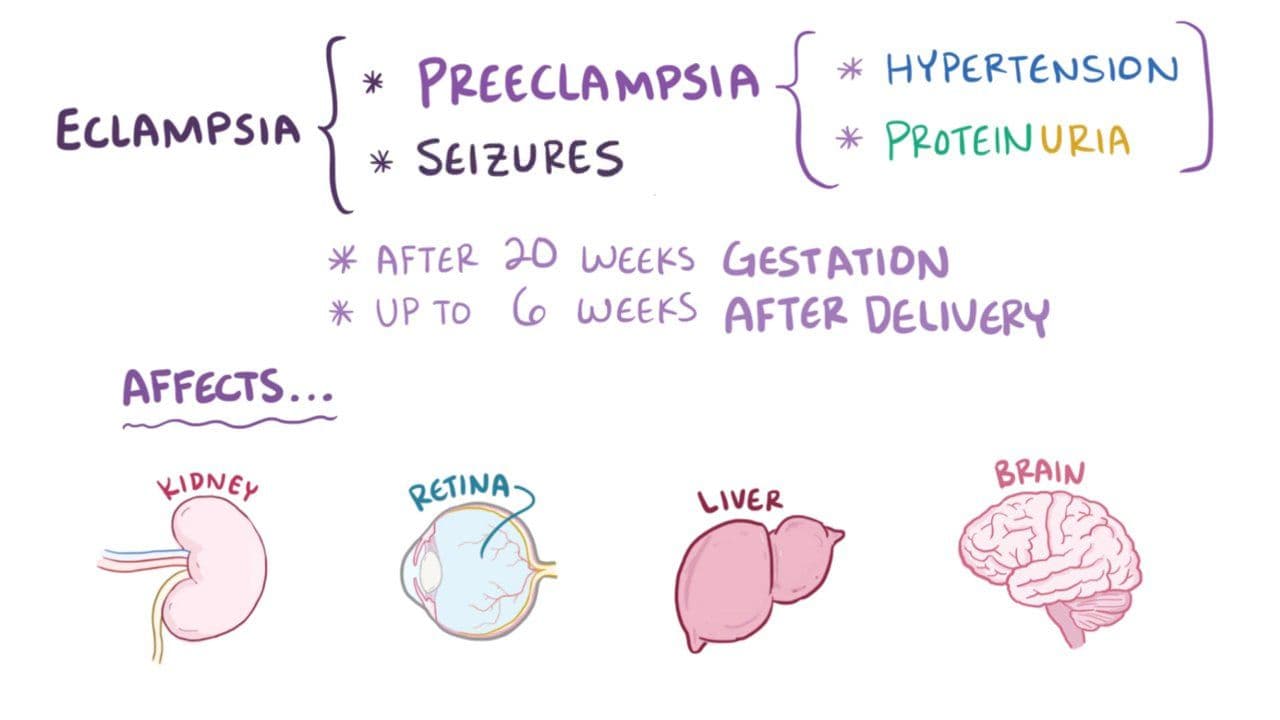 Preeclampsia & eclampsia: Video, Anatomy & Definition | Osmosis