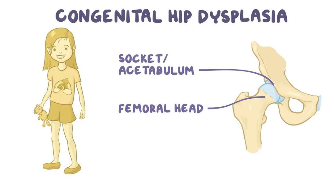 video-osteomyelitis