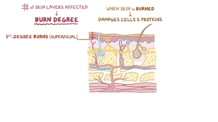 Burns: Video, Anatomy, Definition & Function | Osmosis
