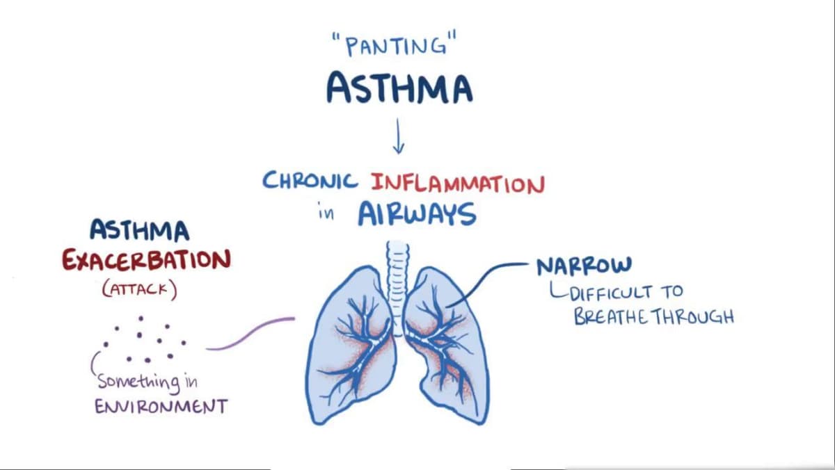 Asthma: Video, Anatomy, Definition & Function | Osmosis