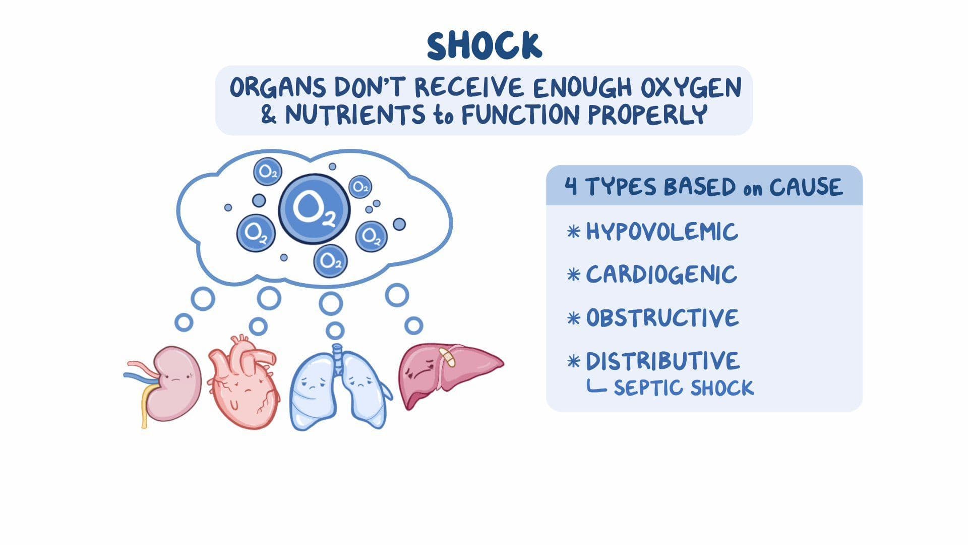 Shock Simlifed Nursing Shock