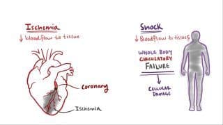 Shock Information.pdf Shock Notes: Diagrams & Download PDF | Osmosis