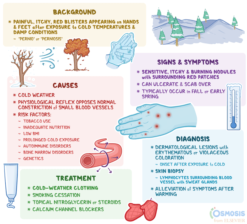 Chablain Rash Chilblains: What Is It, Causes, Signs, Symptoms, and More | Osmosis