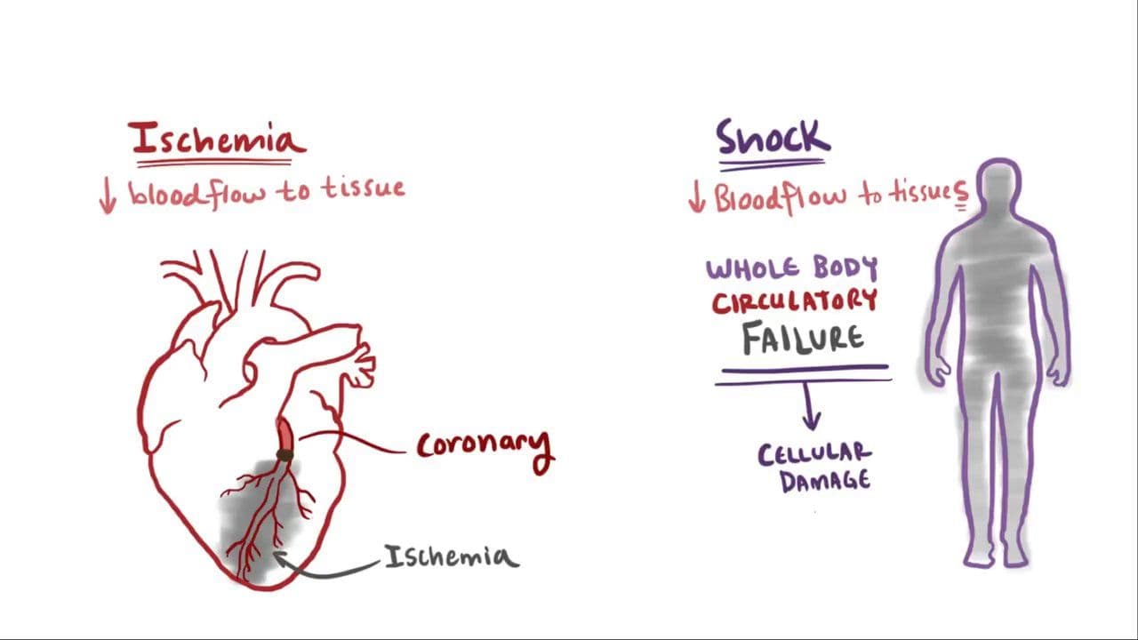 Normal Shock Visualized Shock: Video, Anatomy, Definition & Function | Osmosis