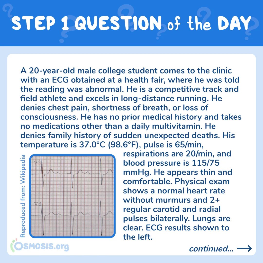 USMLE® Step 1 Question of the Day: AV Block