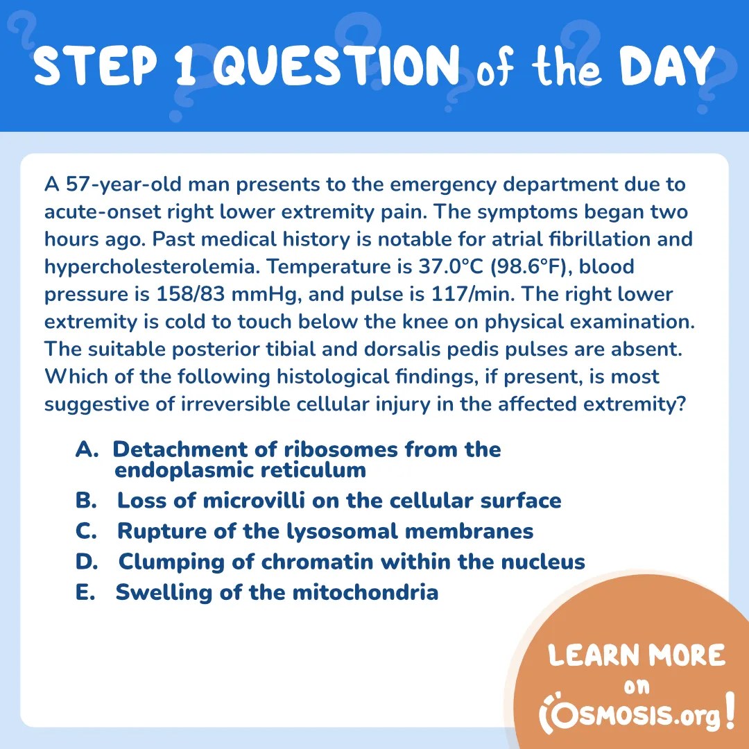 USMLE® Step 1 Question of the Day: Lower extremity pain