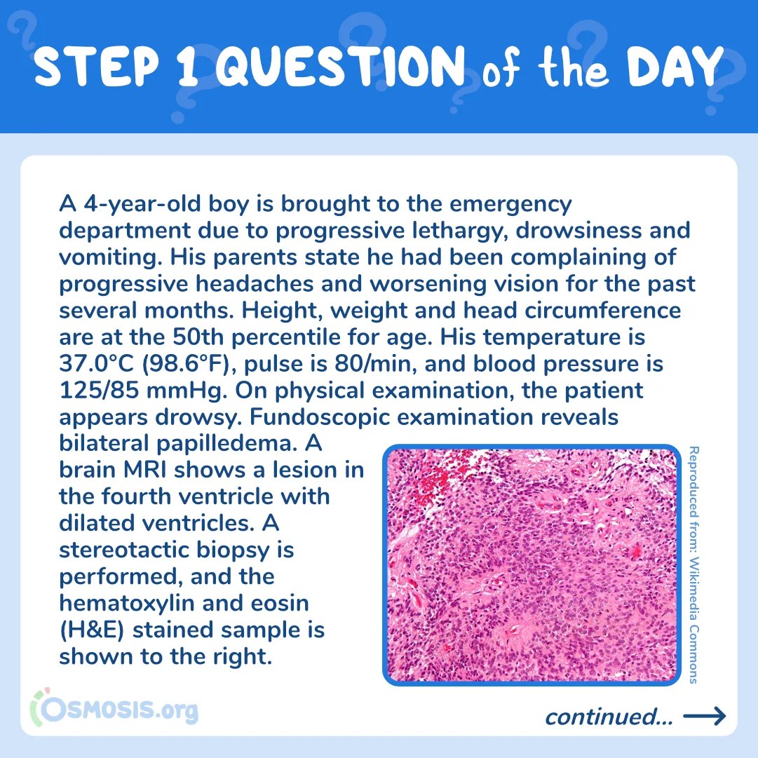 USMLE® Step 1 Question of the Day: Progressive Lethargy