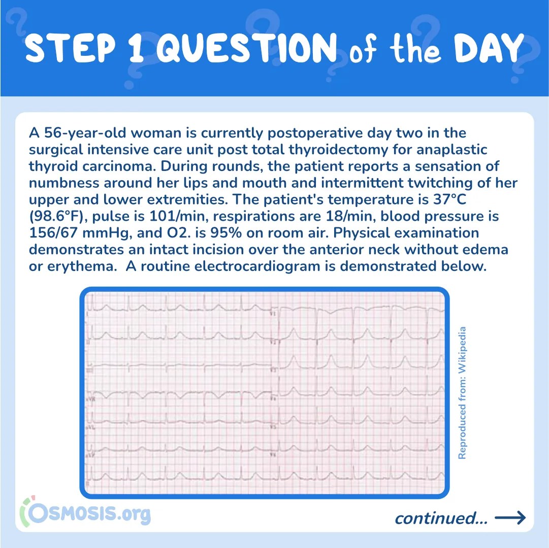 USMLE® Step 1 Question of the Day: Thyroidectomy