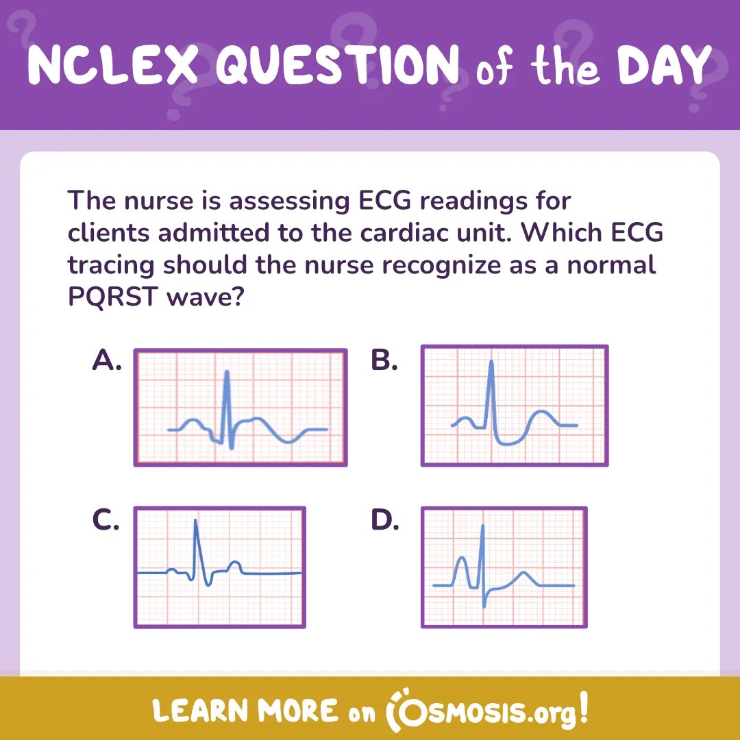 NCLEX-RN® Question of the Day: Normal PQRST wave