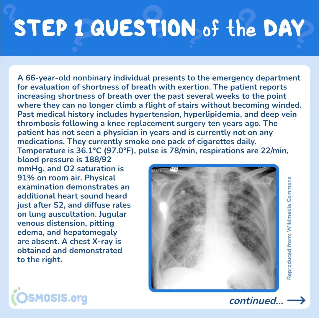 USMLE® Step 1 Question of the Day: Left heart failure