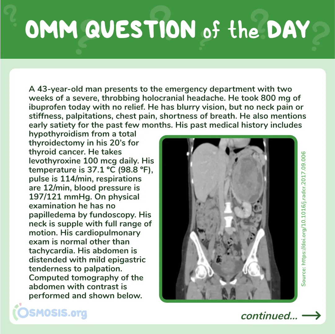 OMM Question of the Day: Chapman Points
