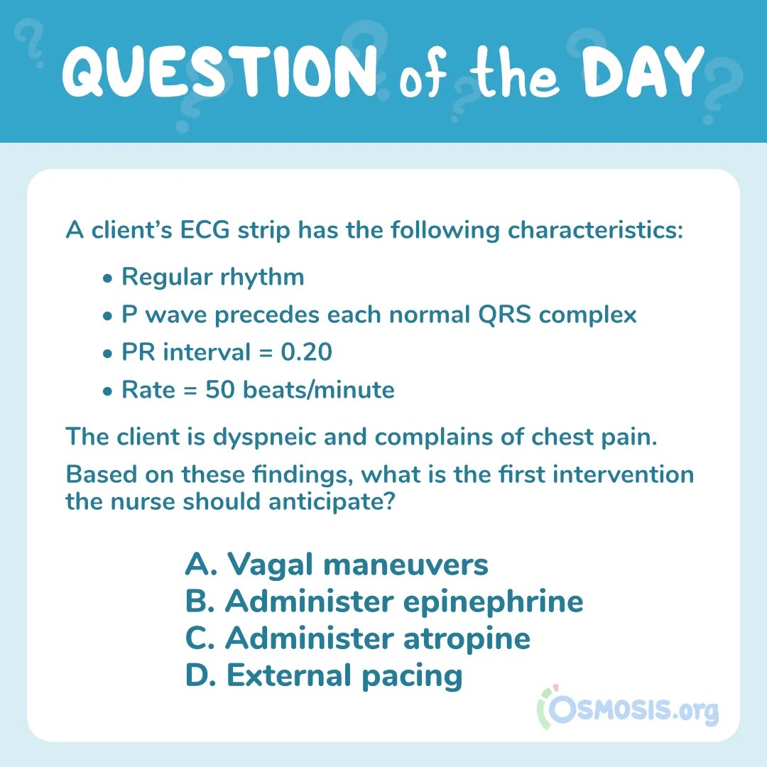 NCLEX® Question of the Day: ECG Strip