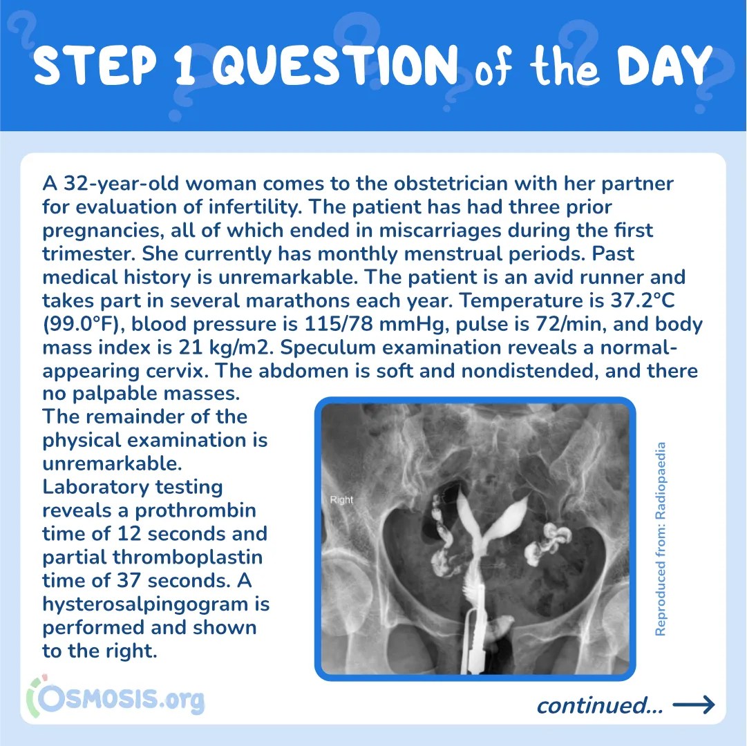 USMLE® Step 1 Question of the Day: Bicornuate uterus