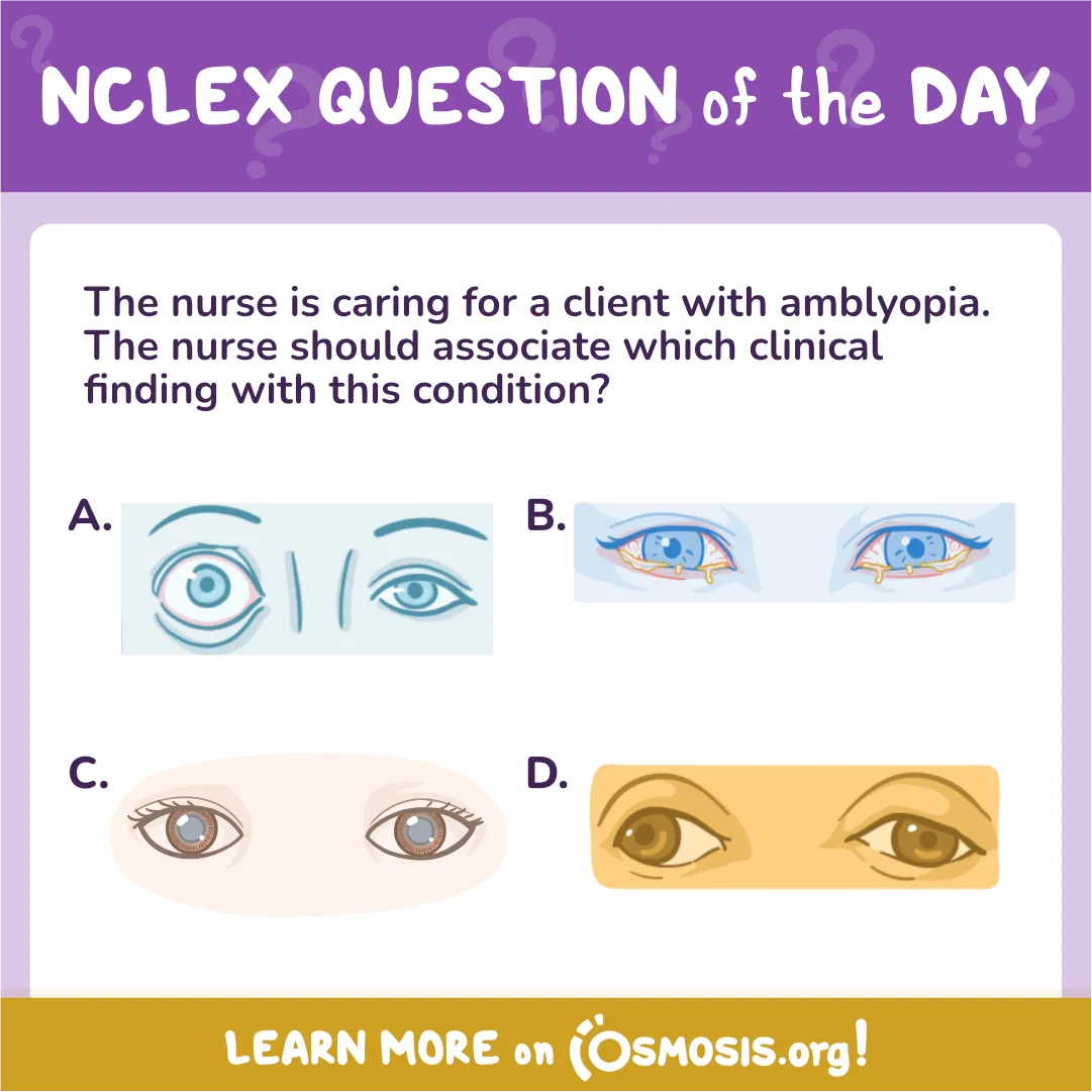 NCLEX-RN® Question of the Day: Amblyopia