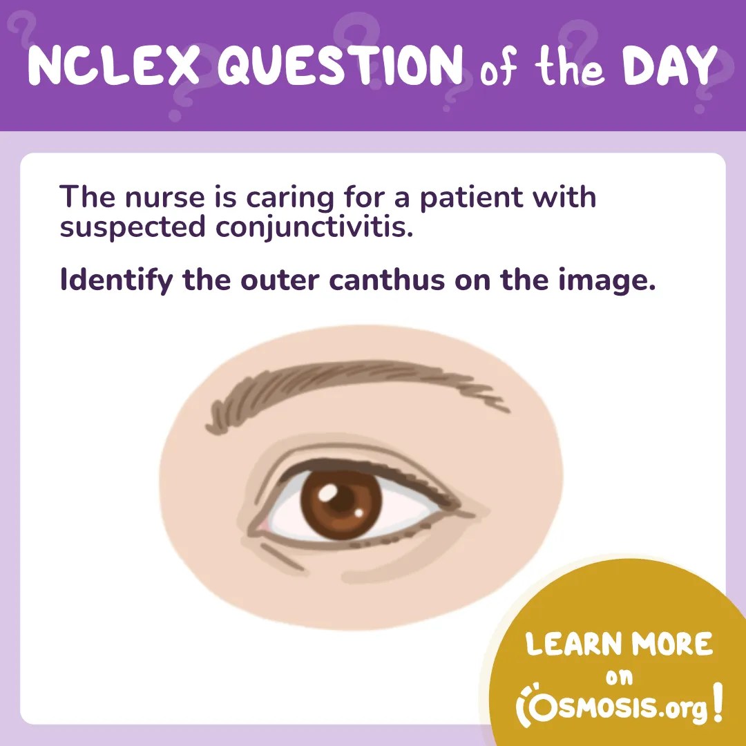 NCLEX-RN® Question of the Day: Outer canthus