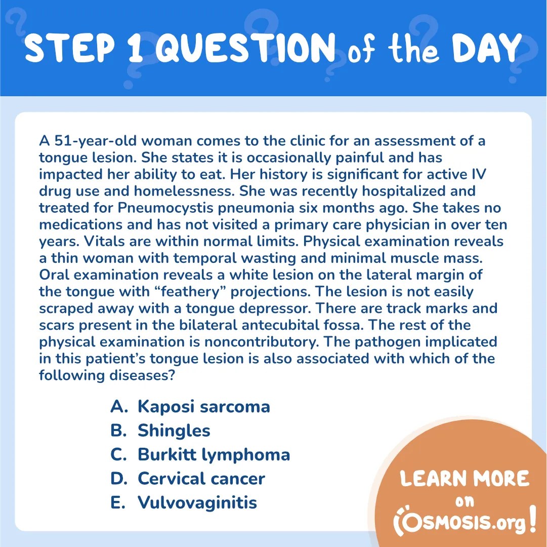 USMLE® Step 1 Question of the Day: Hairy leukoplakia