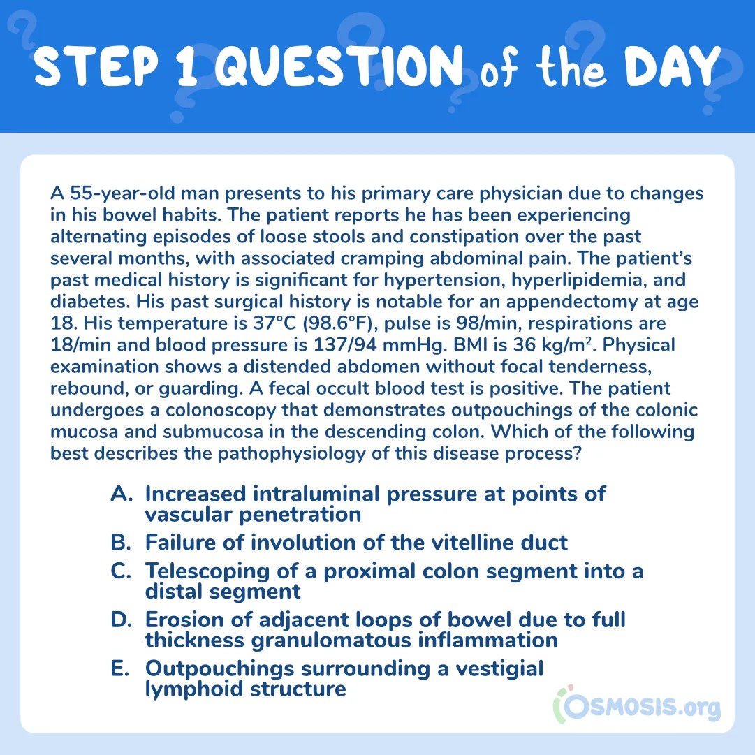 USMLE® Step 1 Question of the Day: Diverticulum Formation