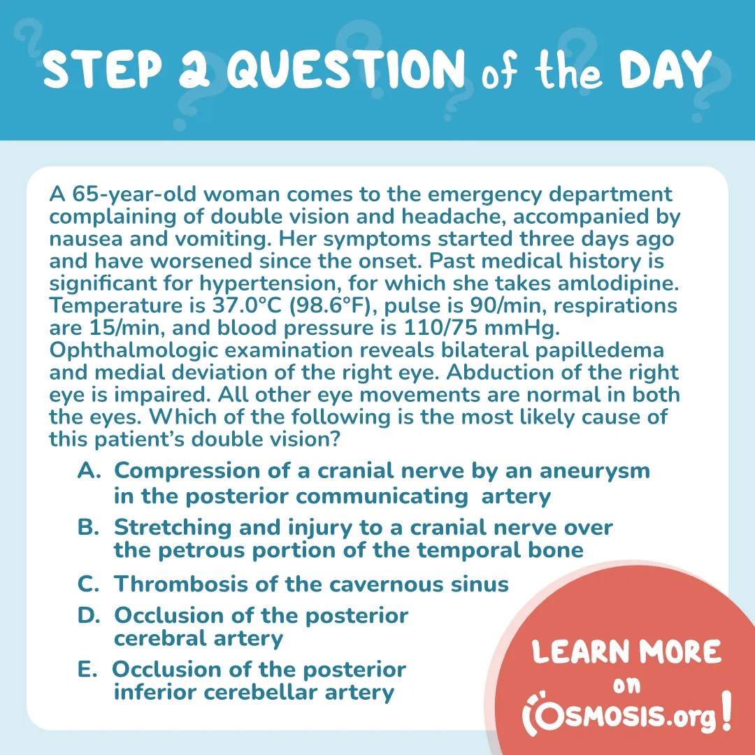 USMLE® Step 2 Question of the Day: Double vision