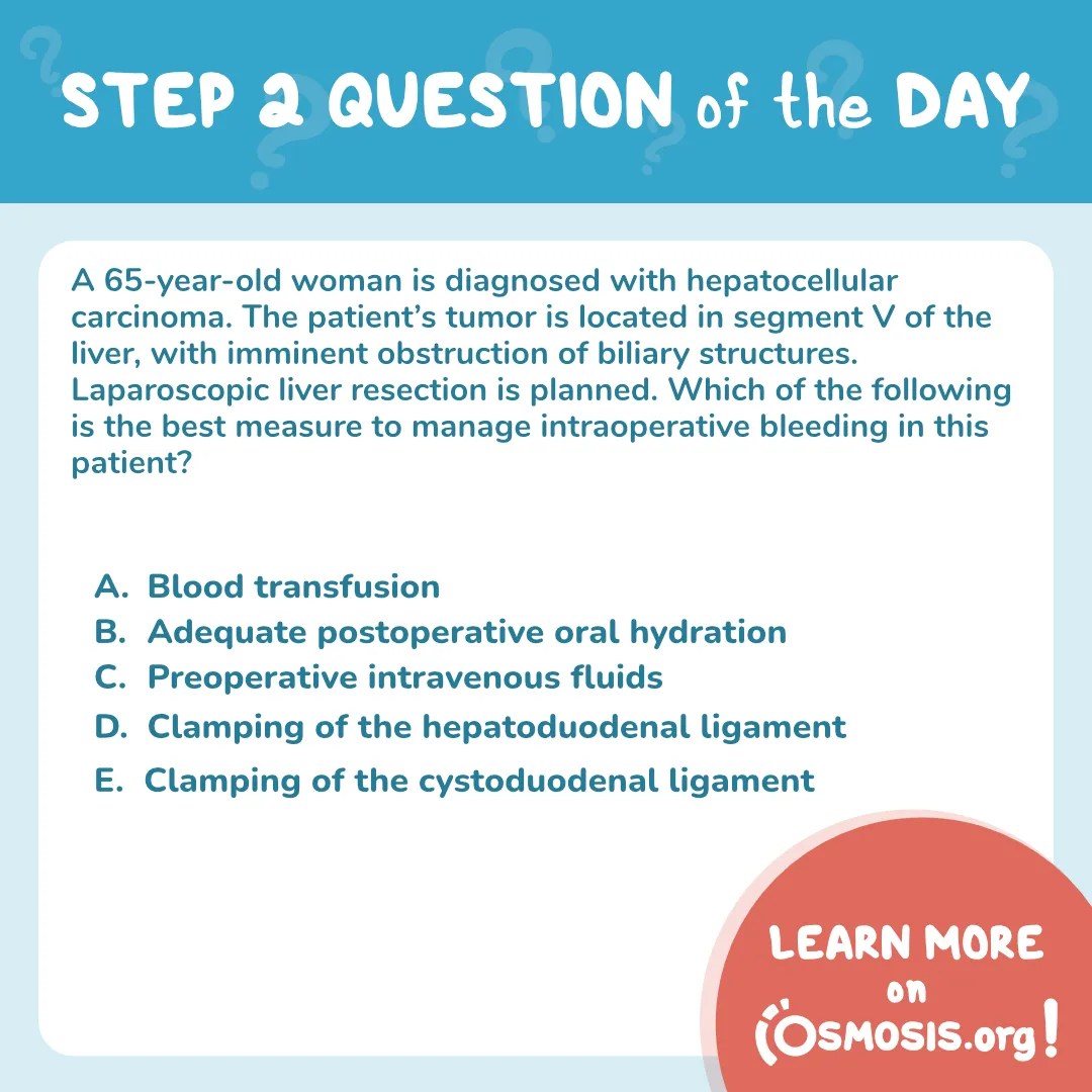 USMLE® Step 2 Question of the Day: Hepatocellular carcinoma