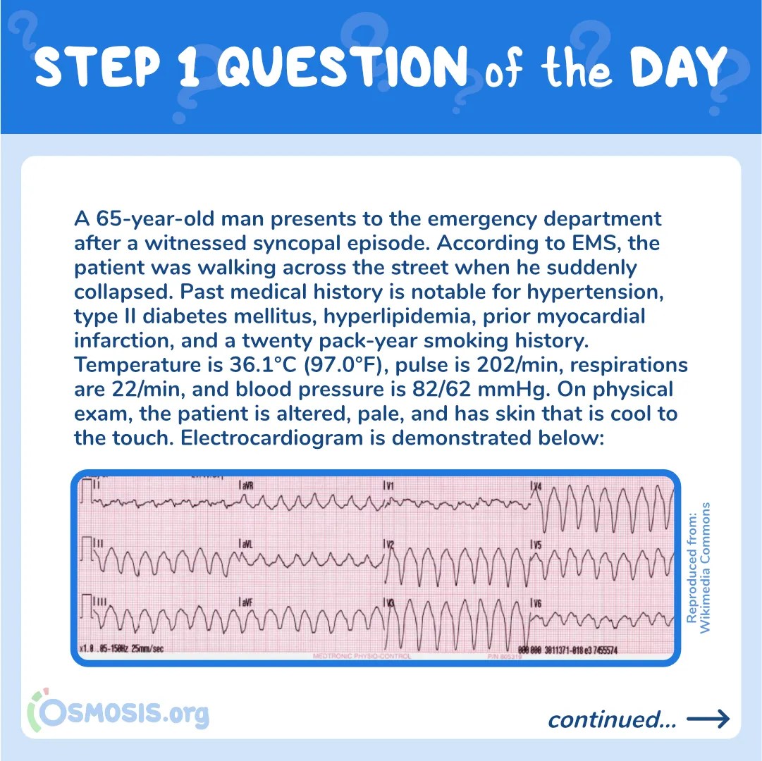 USMLE® Step 1 Question of the Day: Syncopal Episode