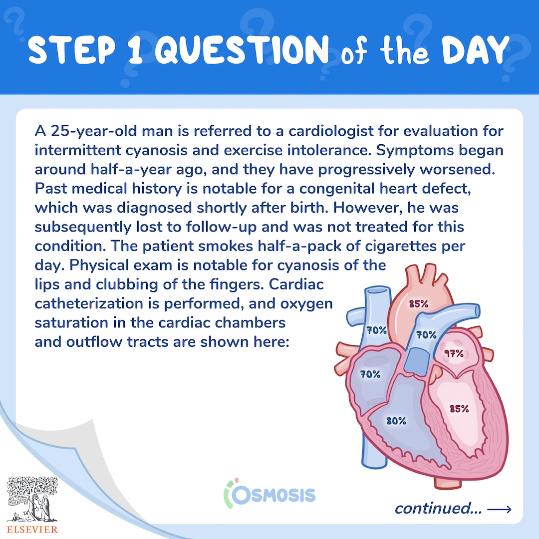USMLE® Step 1 Question of the Day: Cardiac catheterization
