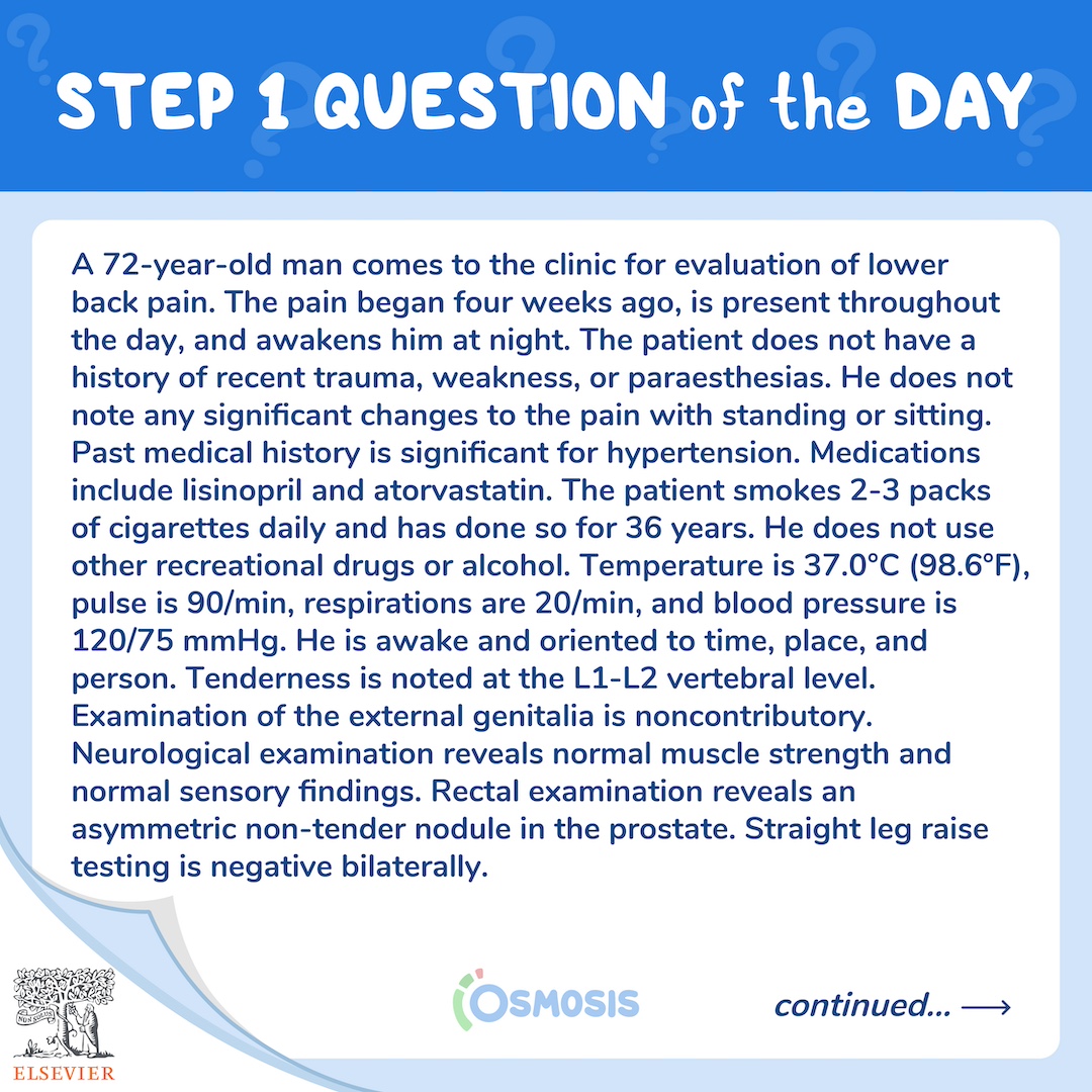 USMLE® Step 1 Question of the Day Prostate nodule