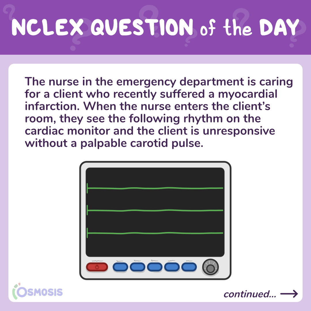NCLEX-RN® Question of the Day: MI unresponsive