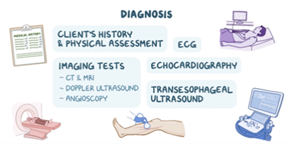 Osmosis.org illustration outlining diagnostic evaluation for a cardiovascular condition, listing the key components of diagnosis, including the client's history and physical assessment, ECG, echocardiography, transesophageal ultrasound, and imaging tests such as CT, MRI, Doppler ultrasound, and angioscopy. Illustrations depict a patient undergoing cardiac imaging, a CT scanner, a Doppler ultrasound of the leg, and an ultrasound machine, representing the range of diagnostic tools used in clinical evaluation.