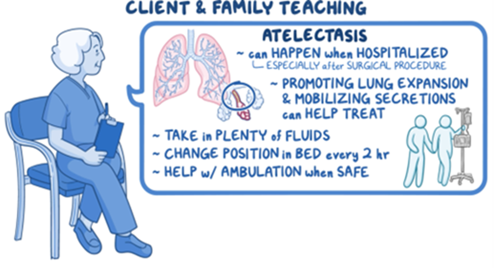 Osmosis educational graphic on client and family teaching for atelectasis. It explains that atelectasis can occur during hospitalization, especially after surgery, and that promoting lung expansion and mobilizing secretions can help treat the condition. Recommended interventions include drinking plenty of fluids, changing position in bed every two hours, and walking with assistance when it is safe. An illustration of a healthcare professional accompanies the teaching points, along with diagrams of the lungs and a patient ambulating with support.