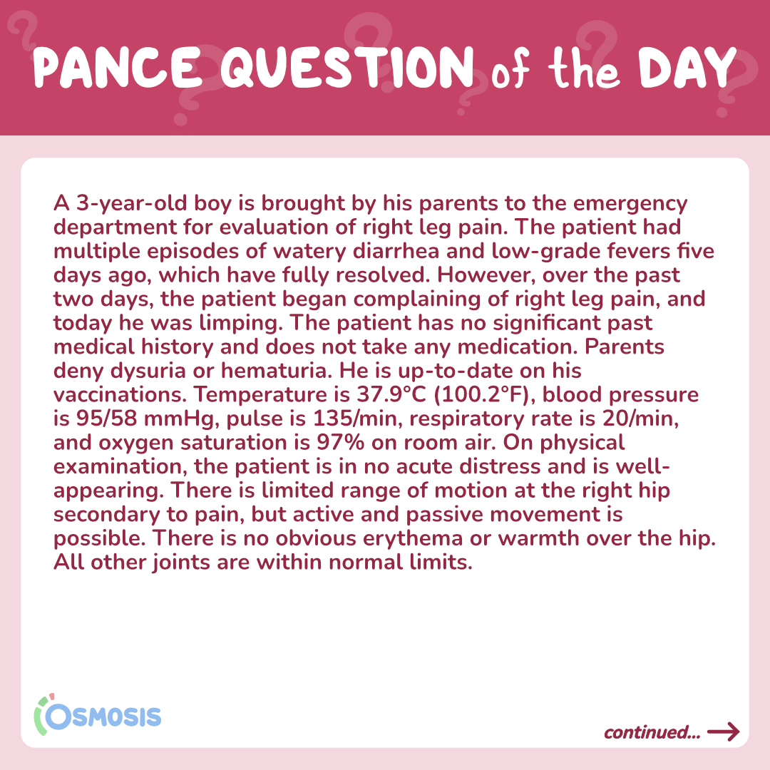 PANCE® Question of the Day Right leg pain