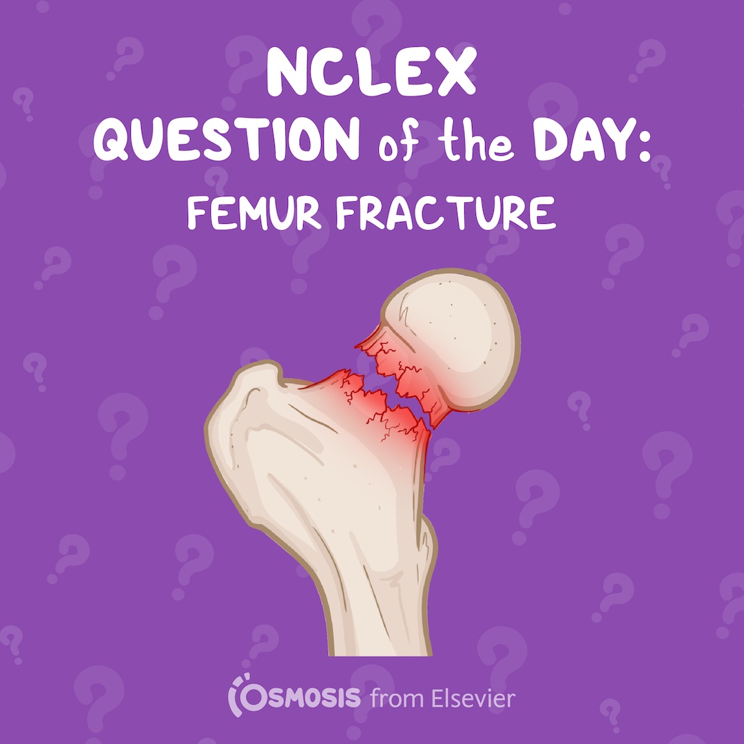 NCLEX-RN® Question of the Day: Femur fracture