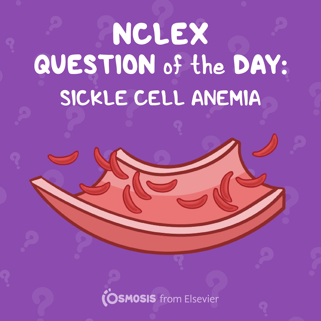 NCLEX-RN® Question of the Day: Sickle cell anemia