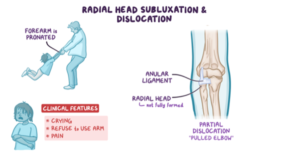 usmle-step-2-ck-question-of-the-day-elbow-pain-osmosis-blog