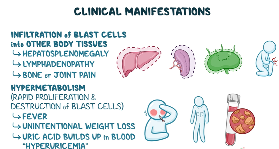 CLINICAL MANIFESTATIONS
Infiltration of blast cells into other body tissues
- Hepatosplenomegaly
- Lymphadenopathy
- Bone or joint pain

Hypermetabolism
(Rapid proliferation and destructions of blast cells)
- Fever
- Unintentional weight loss
- Uric acid builds up in blood "Hyperuricemia