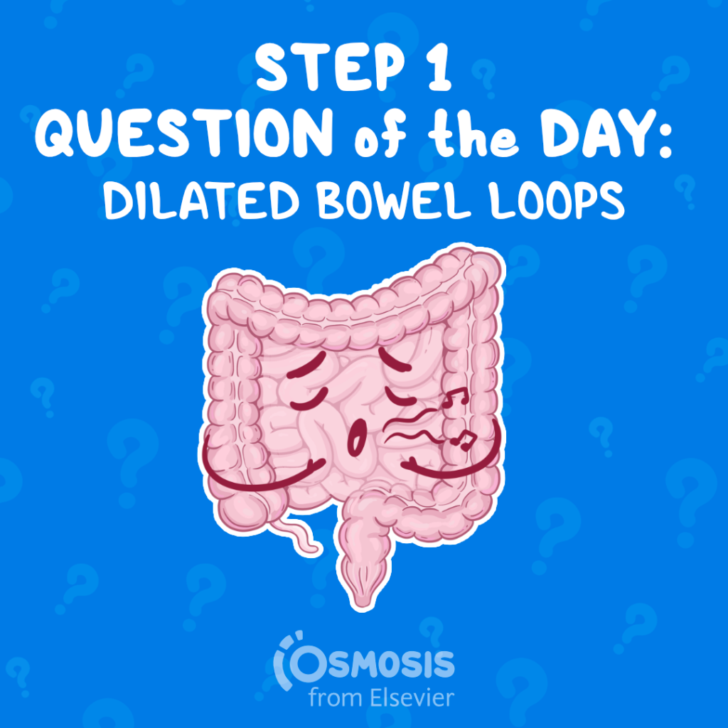 USMLE® Step 1 Question of the Day: Dilated bowel loops