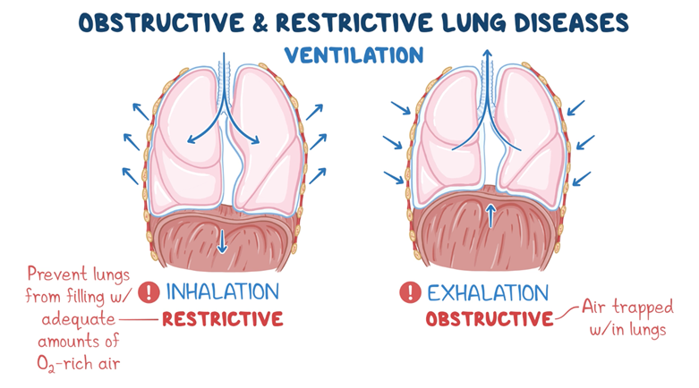 OBSTRUCTIVE & RESTRICTIVE LUNG DISEASES
Ventilation
Inhalation Restrictive: Prevent lungs from filling with adequate amounts of O2-rich air.
Exhalation Obstructive: Air trapped within lungs.