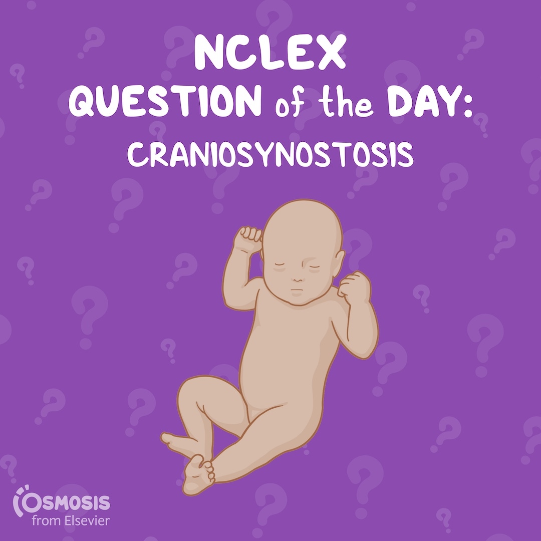 NCLEX-RN® Question of the Day: Craniosynostosis
