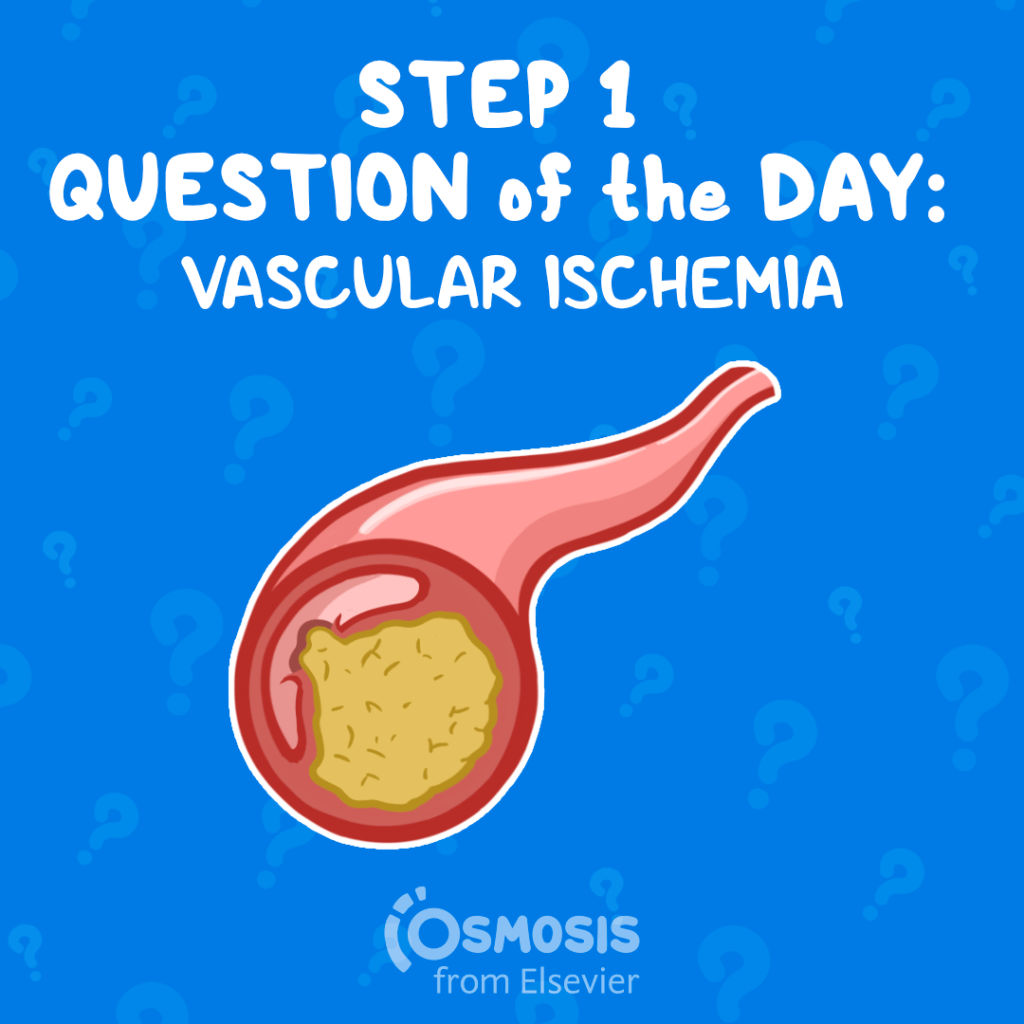 USMLE® Step 1 Question of the Day: Vascular ischemia