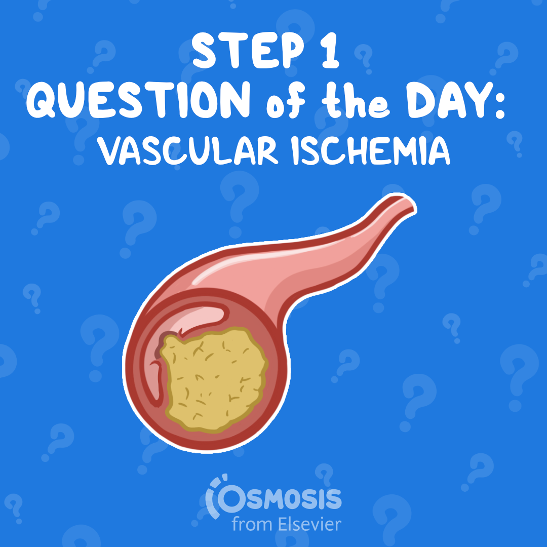 USMLE® Step 1 Question of the Day: Vascular ischemia