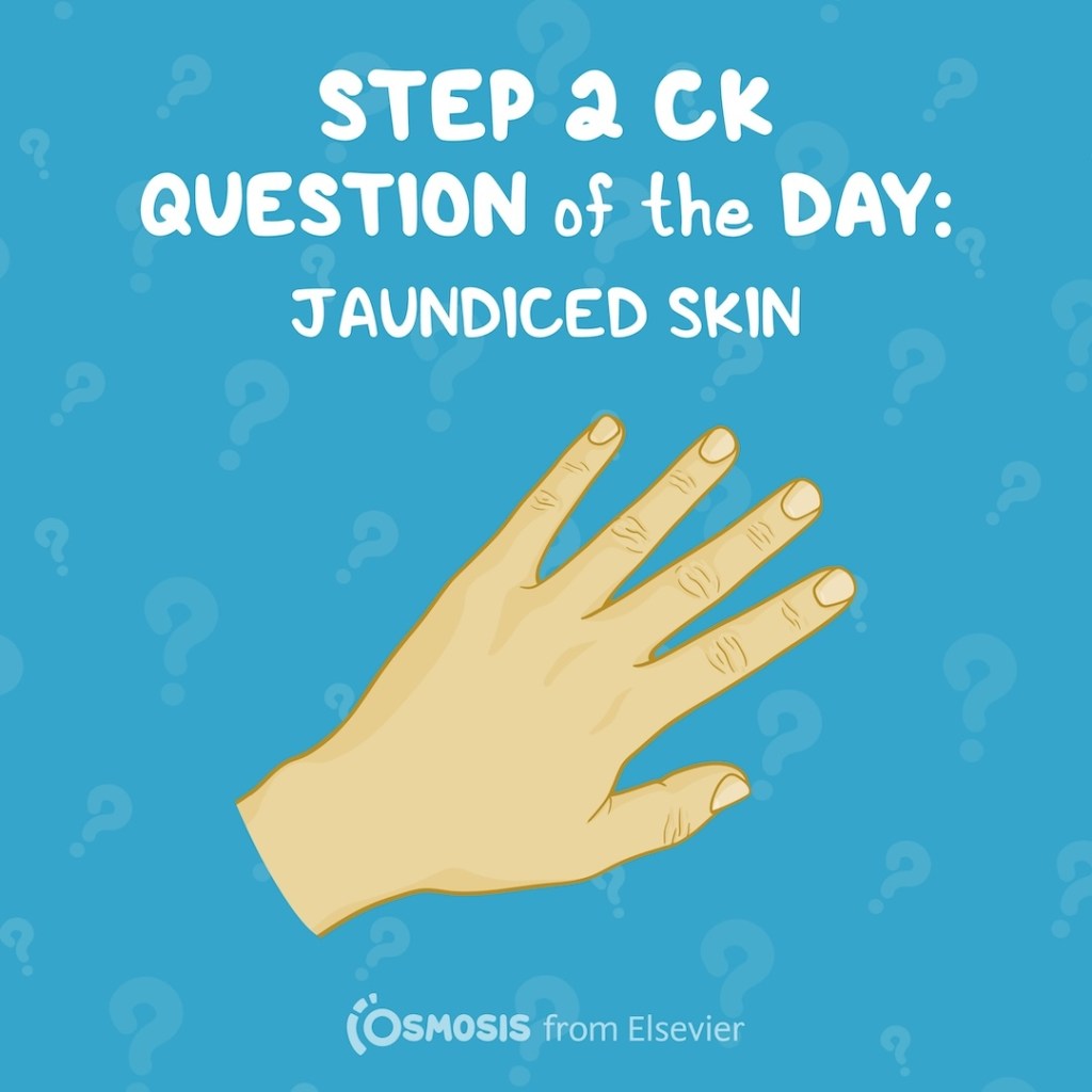 USMLE® Step 2 CK Question of the Day: Jaundiced skin
