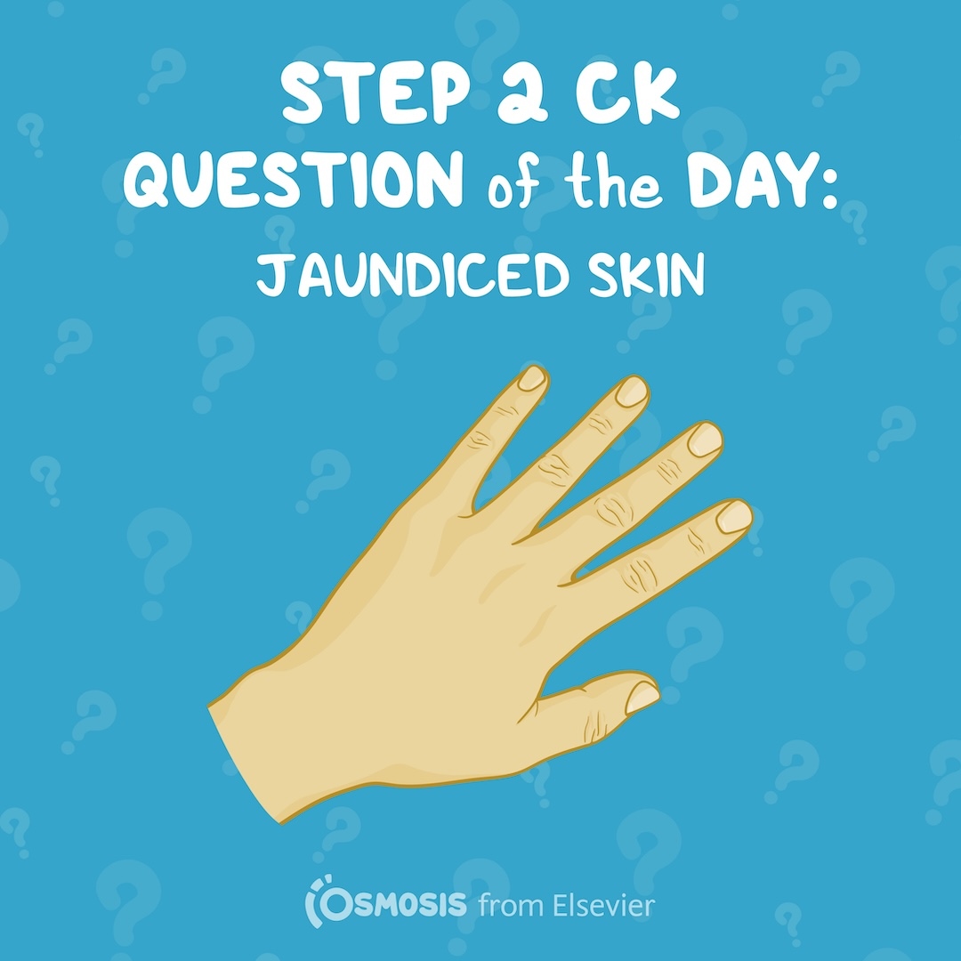 USMLE® Step 2 CK Question of the Day: Jaundiced skin