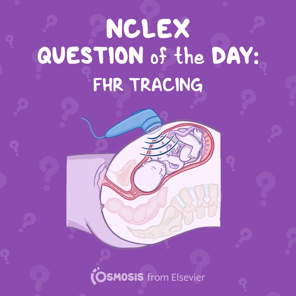 NCLEX-RN® Question of the Day: FHR tracing