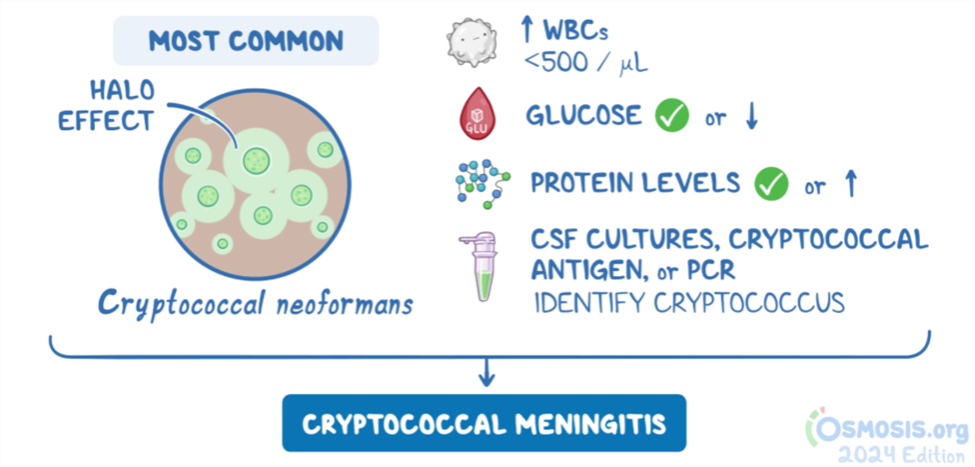 Cryptococcal meningitis overview: Most common cause is Cryptococcus neoformans. Characteristic halo effect on microscopy. Cerebrospinal fluid shows WBCs <500/µL (usually lymphocytic), normal or low glucose, and normal or elevated protein levels. Diagnosis confirmed by CSF culture, cryptococcal antigen test, or PCR.