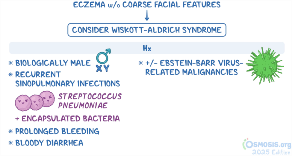 Illustrated medical diagram titled “Eczema without coarse facial features → Consider Wiskott–Aldrich syndrome.” The image lists key clinical clues. On the left, a biologically male child (XY symbol) is shown with recurrent sinopulmonary infections, especially due to *Streptococcus pneumoniae* and other encapsulated bacteria. Additional findings include prolonged bleeding and bloody diarrhea. On the right, the history section notes a possible association with Epstein–Barr virus–related malignancies. The overall graphic emphasizes recognizing Wiskott–Aldrich syndrome based on eczema, infection pattern, bleeding symptoms, and patient demographics.