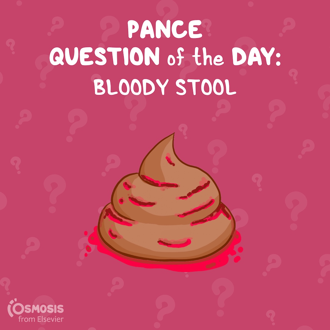 PANCE® Question of the Day: Bloody stool