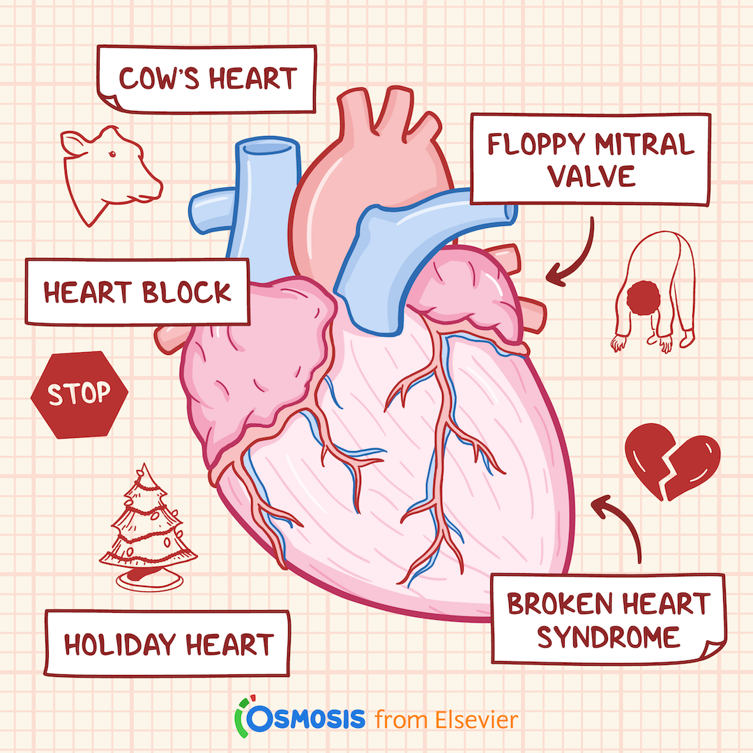 The Origins of 13 Heart Conditions with Unusual Names